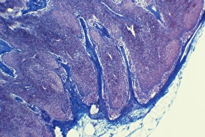 Immune System Cells Stampe: Lymph node, light micrograph C015 / 6223