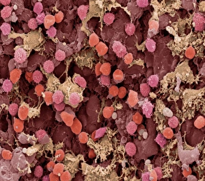 Stampe di Il nodolo linfatico. Immagine di risonanza elettronegativa colorata del SEM su una sezione congelata attraverso un nodo linfatico, mostrando parte dell'apertura sinusa medullare Immagini del 27 gennaio 2003: Nodo linfatico, SEM