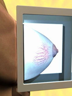 Medical Imaging Technology Stampe: Mammogram, conceptual image