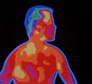 Thermography Images Stampe: Mans thermogram
