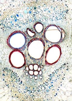 Stemma del midollo osseo, immagine a lente ottica leggera