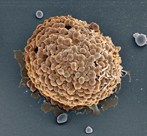 Scanning Electron Microscope Images Stampe: Mast cell, SEM