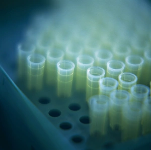Stampe di I tubi microscopici conservati su un carrello. I tubi microscopici possono essere utilizzati nei centrifughi, dove una liquido viene separato nelle sue parti costitutive con rotazione rapida Immagini datate 2003 novembre: Microtubes