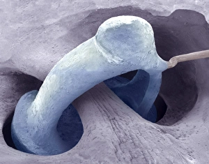 Scanning Electron Micrograph SEM Images Stampe: Middle ear bone, SEM