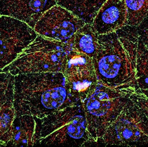 Cell Division Stampe: Mitosis, fluorescence micrograph