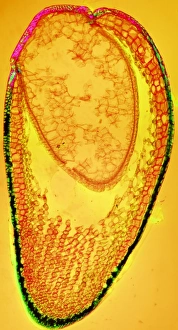 Polarised Light Micrograph Stampe: Moss spore capsule, light micrograph