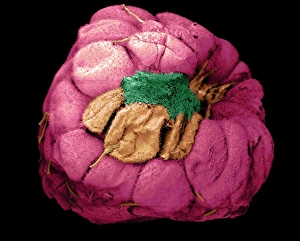 Stampe di Raspberries muffa. Immagine elettronica di scansione a raggi verde del miele dell'arancia colpita dalla muffa, con magnificazione sconosciuta Immagini del 15 settembre 2000: Raspberries marciti