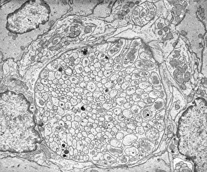 Transmission Electron Micrograph TEM Stampe: Myenteric nerve plexus, TEM