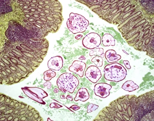 Light Microscopy Images Stampe: Nematode infection, light micrograph