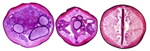Stampe di Cefalo di nematode. Micrografia luminosa di tre sezioni trasversali attraverso il corpo di una femmina del verme a forma sferica e non segmentato (Ascaris lumbricoides) Immagini datate 2008 novembre: Cefalota di nematodo, sezioni trasversali