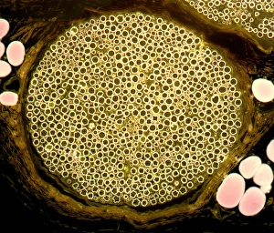 Myelin Sheath Structure Stampe: Nerve bundle, light micrograph