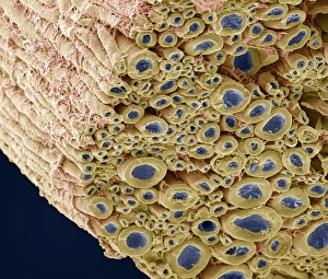 Myelinated Nerve Fibres Stampe: Nerve bundle, SEM