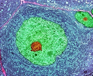 Cellula nervosa, TEM