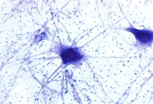 Nerve Cells Stampe: Nerve cells, light micrograph
