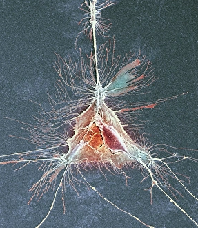 Myelin Sheath Formation Stampe: Nerve support cell, SEM