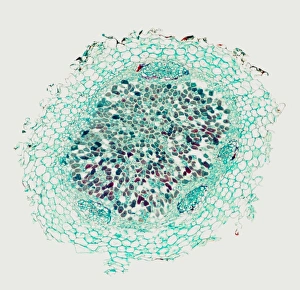 Immagini datate 2006 ottobre: Fibra radicale che forma nodoli per fissare l'azoto, fotografia a microscopio