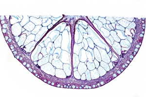 Stampe di Fruutta arancione. Microfotografia leggera di una sezione attraverso il frutto di un albero da agrumi amari (Citrus aurantium), mostrando le grandi sette (segmenti) Immagini datate 2012 gennaio: Frutto di arancia, micrografo leggero