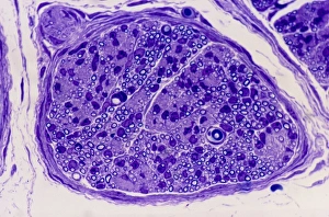 Nerve Cell Structure Stampe: Peripheral nerve, light micrograph