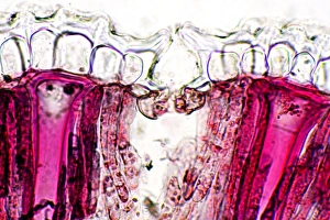 Polarised Light Microscopy Images Stampe: Pincushion leaf, light micrograph
