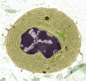 Cellula plasmatica con microscopio elettronegativo (TEM)