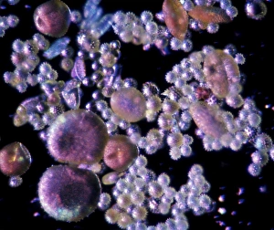 Pollen Grain Morphology Stampe: Pollen, light micrograph