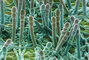 Coloured SEM Images Stampe: Powdery mildew on leaf