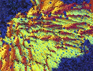Polarised Light Microscopy Stampe: Progesterone hormone, light micrograph