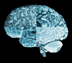 Neurology Images Stampe: Quartered brain