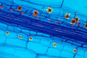 Polarised Light Microscopy Stampe: Rhubarb leaf, light micrograph