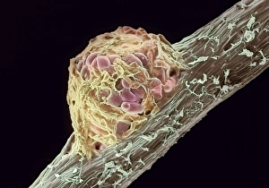 Stampe di Un nodolo di radice. Immagine a raggi X elettronici colorata (SEM) d'un nodo di radice su una pianta di pisello (Pisum sativum) causato dai batteri del legame azotofissante Rhizobium leguminosarum Immagini datate 2004 ottobre: Nodo radicale