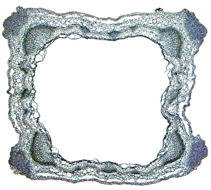 Vascular Bundle Structure Stampe: Sage stem, light micrograph