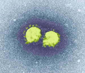 Coloured TEM Images Stampe: SARS virus particles, TEM