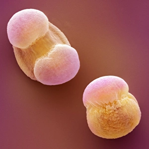 SEM Images Of Pollen Stampe: Scots pine pollen, SEM