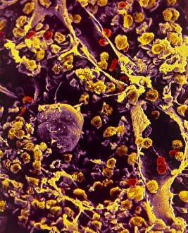 Human Body Bone Structure Stampe: SEM of bone marrow