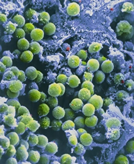 Human Immune System Cells Stampe: SEM of lymphocytes in cortex of thymus