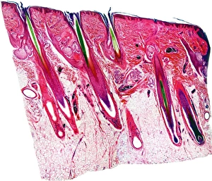 Epidermis And Dermis Layers Stampe: Skin section, light micrograph