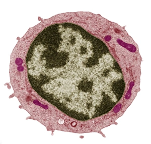 Stampe di Piccolo linfocita. Micrografia di trasmissione elettronica colorata (TEM) che mostra il grande nucleo centrale (bruno) di un piccolo linfocita (cellula bianca del sangue) Immagini datate 15 dicembre 2008: Piccolo linfocita, TEM