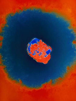 Smallpox Virus Stampe: Smallpox virus