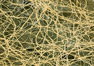 Stampe di La rete delle ragnatele. Micrografia a colori di elettroni scarabici (SEM) della trama dei filamenti del ceraio (giallo) che avvolge un carassolino Immagini datate 2003 ottobre: Ragni rete, SEM