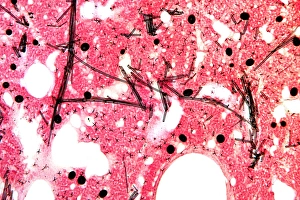 Stampe di Tessuto di spugna. Micrografia a luce debole della sezione attraverso il corpo dell'elefante-spongia (Pachymatisma johnstonia) Immagini datate 2008 novembre: Tessuto spugna, micrografia leggera