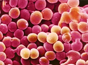 SEM Stampe: Batterio Stafilococco aurei