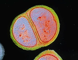 Stampe di Immagine di trasmissione elettronegativa ad colore falso (TEM) di un singolo batterio del genere Staphylococcus epidermidis in fase di divisione. Magnificazione : x17,5 a 35mm, x38,5 a 6x7cm Immagini datate 2003 dicembre: Bacchio Stafilococco epidermidei
