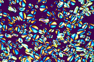 Polarised Light Microscopy Stampe: Starch grains, light micrograph