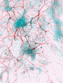 Stampe di Le celle staminali derivanti dai neuroni. Micrografia luminosa di cellule nervose umane (neuroni) derivate dalle cellule pluripotenziali indotte (IPS) Immagini datate 2012 dicembre: Cellule derivanti da staminali nervosi, micrografia