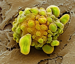 Immagini del 7 marzo 2013: La cellula madre muore, SEM