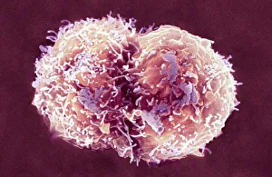 Stampe di Iliocelli madre, grafica di rilievo elettronico coloreato (SEM). Iliocelli madre possono differenziarsi in qualsiasi altro tipo cellulare Immagini datate 2008 febbraio: Cellule staminali