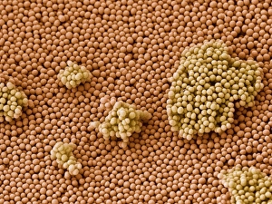 SEM Images Of Bacteria Stampe: Streptococcus bacteria, SEM