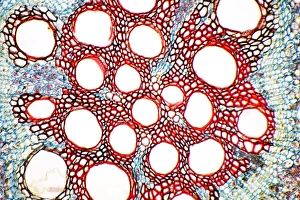 Light Micrograph Stampe: Sweet potato root, light micrograph