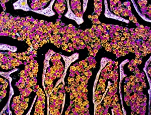 Intestinal Parasites Stampe: Tapeworm proglottid, light micrograph