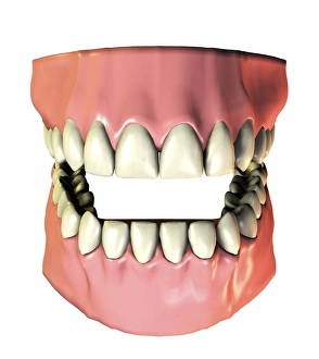 Stampe di Denti e gengive, arte informatica di denti e gengive sani in computer grafica. Gli adulti hanno 32 denti permanenti Immagini datate 2006 agosto: Denti e gengive